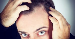 Neue-Studie-–-kann-Koffein-doch-Haarausfall-verhindern